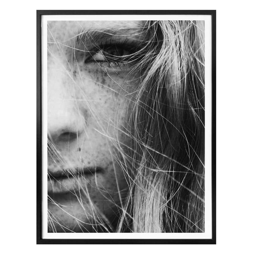 Poster - Lentiggini
